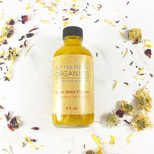 Load image into Gallery viewer, Acne-Fighting Face Oil - Natural Acne Treatment - Organic Acne Serum - Blemish And Scar Remover - Facial Oil For Acne-Prone Skin - Natural Scar Treatment - Antioxidant Facial Serum - Best Oil For Acne Scars - Oil Serum For Acne And Blemishes